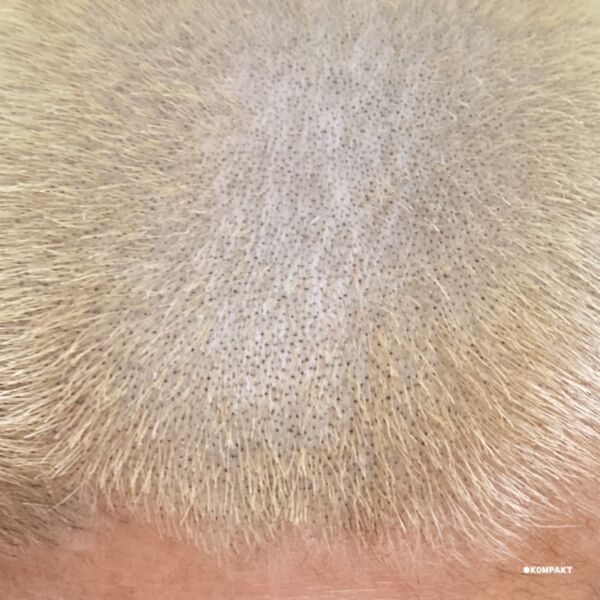 PROMETAL FAN DECOR ONLY PRODUCT