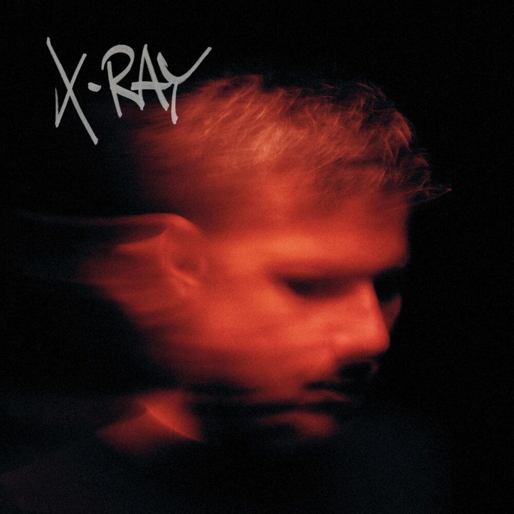X-RAY main product photo